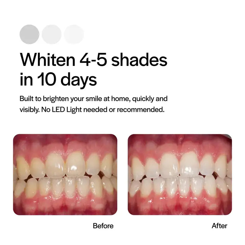 Skinvae Go™ 15% Prefilled Whitening Trays