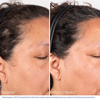 Skinvae Nu-Cil® BioStim™ Scalp Serum