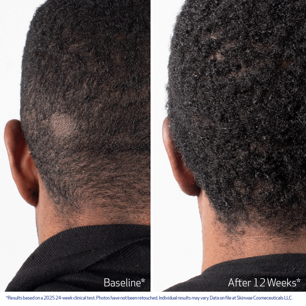 Skinvae Nu-Cil® BioStim™ Scalp Serum