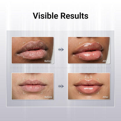 Peptides Nourishing Lip Serum