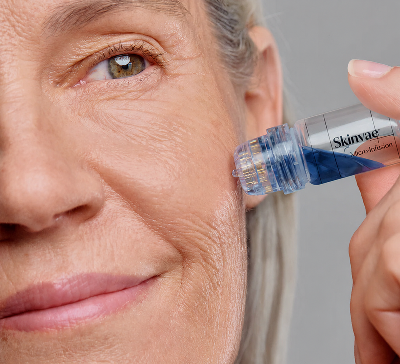 Skinvae Micro Infusion Kit