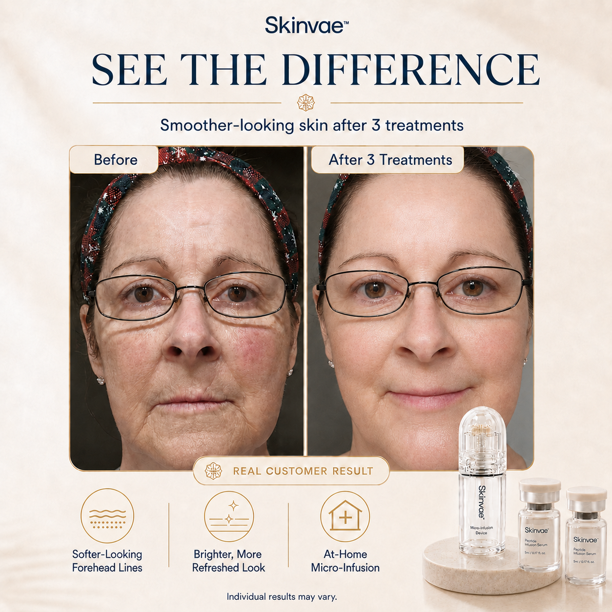 Skinvae™ Micro Infusion Kit