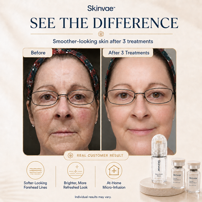 Skinvae™ Micro Infusion Kit