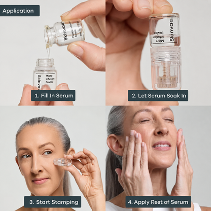 The Micro Infusion System™